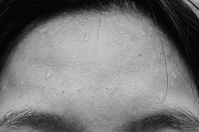 Kalter Schweiß - Ursachen, Behandlung & Hilfe | MedLexi.de