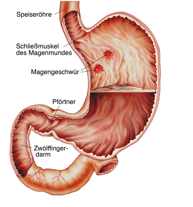 medlexi.de