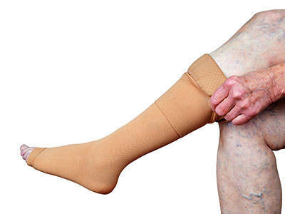 Postthrombotisches Syndrom Ursachen Symptome Behandlung Medlexi De