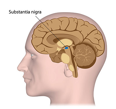 Substantia Nigra Aufbau Funktion Krankheiten MedLexi de