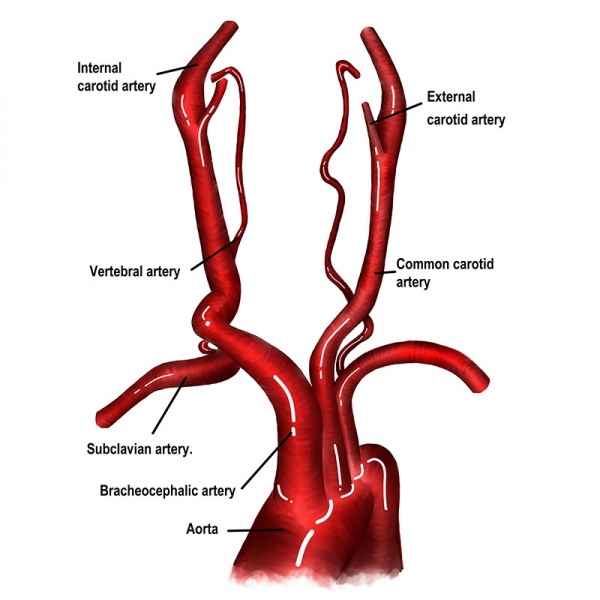 Datei:Arteria vertebralis.jpg