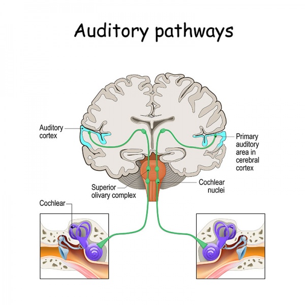 Datei:Auditiver Cortex.jpg