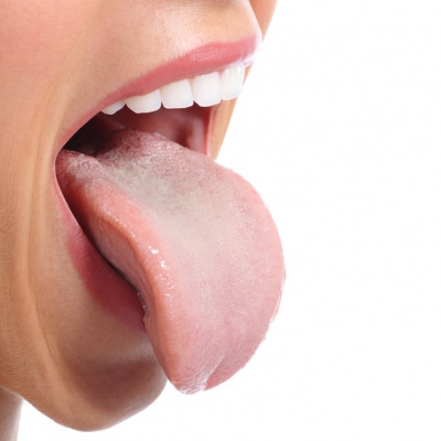 Zunge kleine auf der weiße pickel Weißer Zungenbelag,