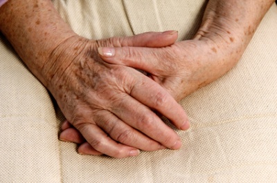Hand der flecken braune auf Alterswarzen: Ursachen,