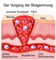 Vorschaubild für Version vom 09:40, 21. Aug. 2020